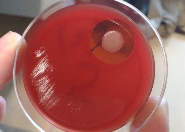 bacterial culture on a petri dish